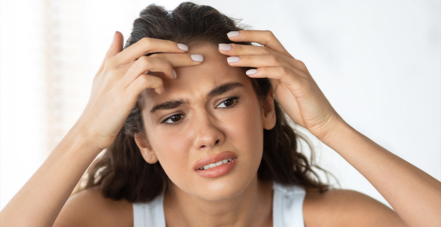 GETTING RID OF ACNE: ALL YOU NEED TO KNOW